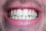 teeth